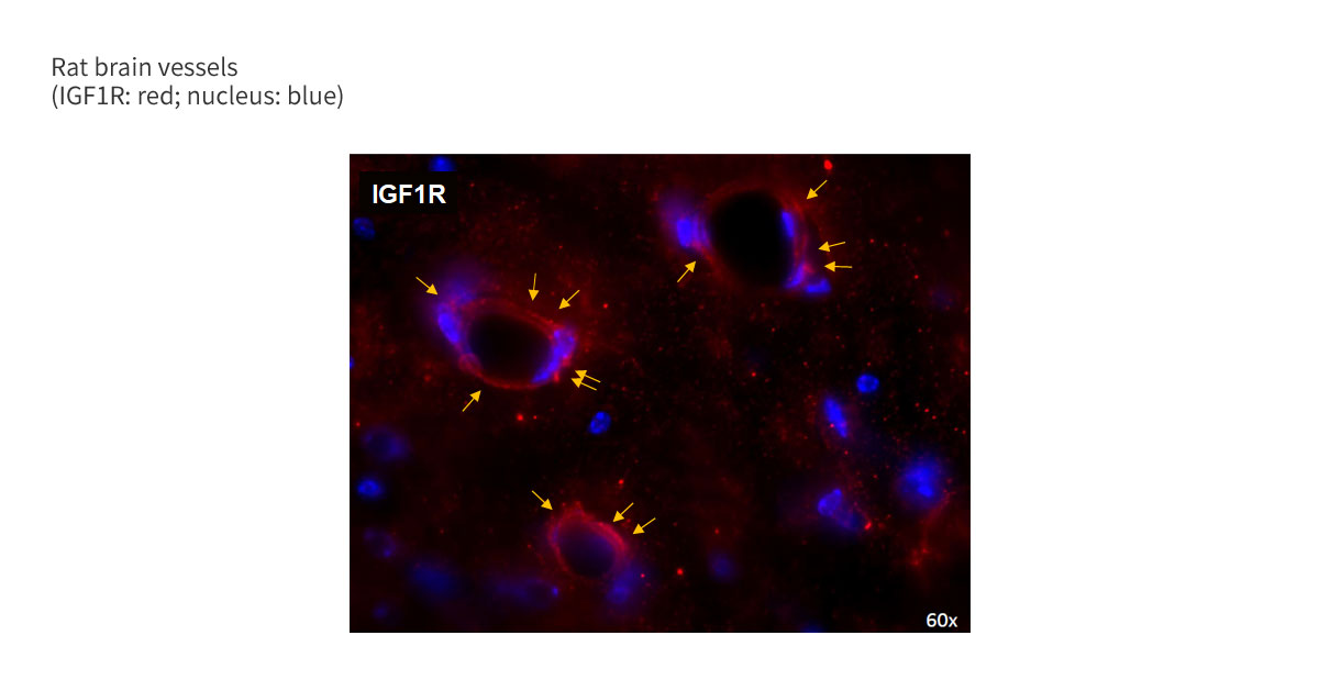 IGF1R is Highly Expressed in Brain Vessels