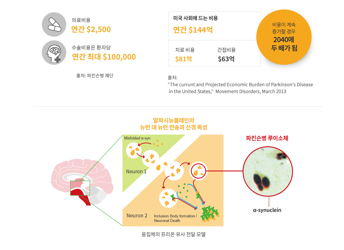 파킨슨 병