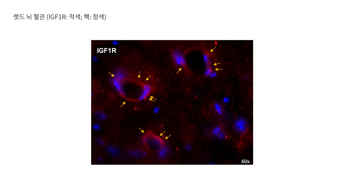 IGR1R은 뇌 혈관에 다수 출현